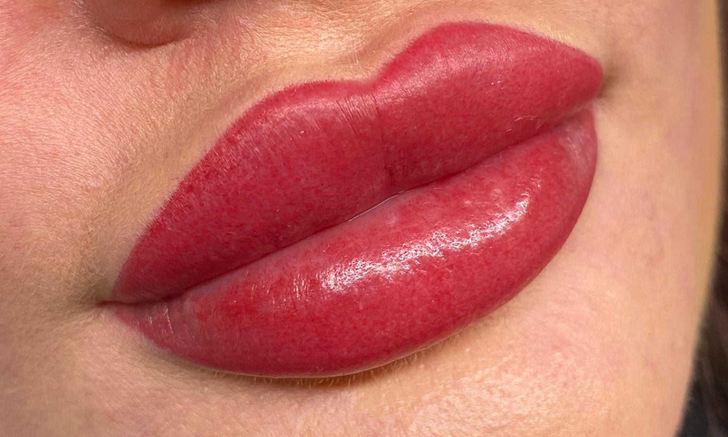 Lippen Pigmentierung Hannover